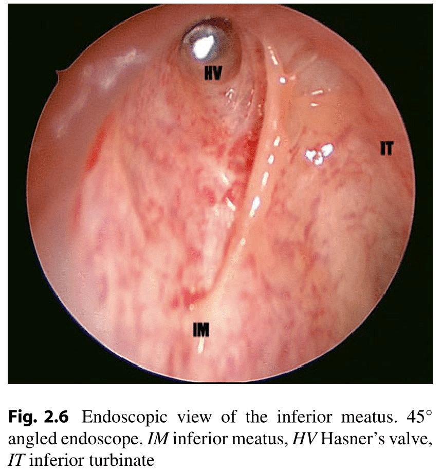Anatomy of Lateral wall of Nose 3 Inferior meatus in Lateral wall of nose
